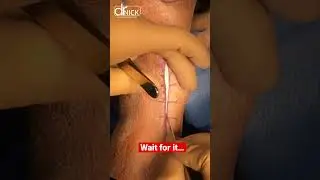 Satisfying incision making! 