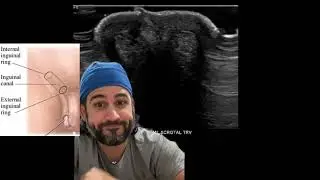 Retractile Testes