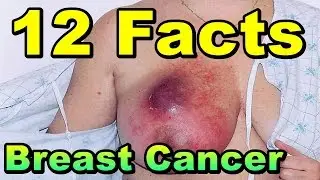 12 Facts about Breast Cancer || Breast Cancer Facts