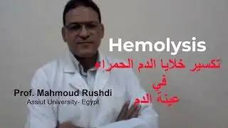 Hemolysis of a blood sample!! تكسير خلايا الدم الحمراء