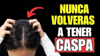 ¿CASPA Este Truco Revolucionario Cambiará Tu Vida