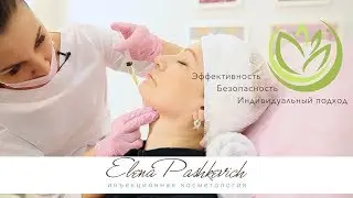 Липолитики для лица, Уменьшить объем лица, Убрать носогубные складки, Убрать брыли