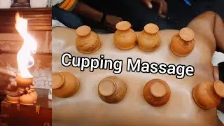 Cupping  Massage and back Massage by Vikram Barber| So Amazing