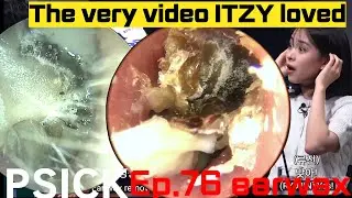 Ep. 76 Earwax removal (Korean ENT doctor “King of earwax”) 귀지형의 Ep.76 귀지제거