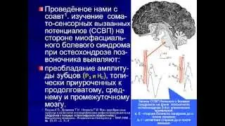 Феномен триггерной точки