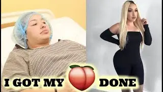My Brazilian Butt Lift & Tummy Tuck Experience PART 1