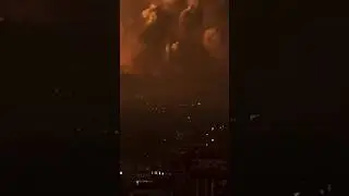 FALASTIN ISROIL QOʼLIDA AZIYAT CHEKYABDI