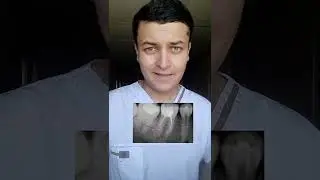 ДАРДИ ДАНДОН БАЪДИ ПЛОМБА