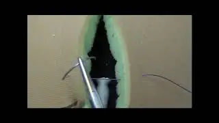 Horizontal Mattress Suture