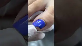 Нарастить или спилить сломанный уголок ногтя ? #nails #педикюр #pedicure