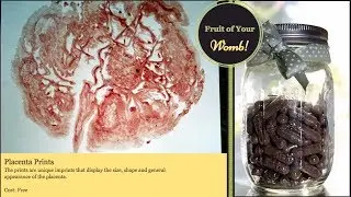 Placenta Encapsulation and Information by a placenta encapsulator.