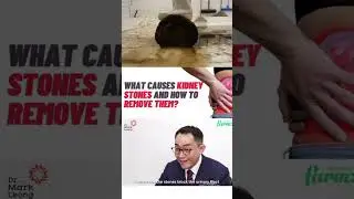 What causes kidney stones and how to remove them?