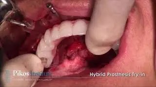 Guided All on 4 Full Arch Surgery CE Continuing Education Course - Pikos Institute