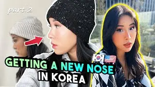 NOSE JOB REVEAL....😳 | plastic surgery in korea