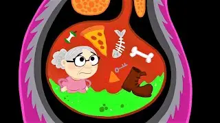 Wolf ate person (LRRHP3)