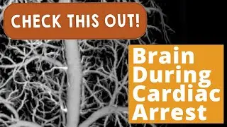 Brain During Cardiac Arrest | Check This Out!