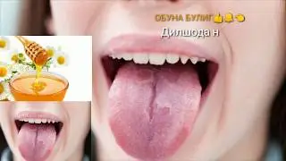 Тил ерилганда и яра булганда&Когда на языке трески появились у детей