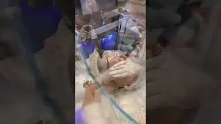 Вакуумная чистка лица HydraFacial