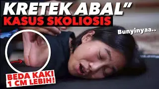 SCOLIOSIS GIRL'S CRACKS.. WATCH USING A HEADSET!