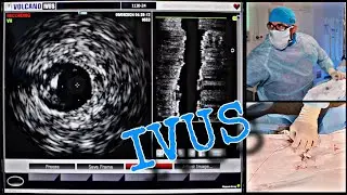 ВСУЗИ 20МГц. В операционной Philips