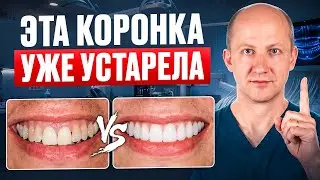 Как выбрать коронку на зуб? Виды коронок на зубы и какие коронки лучше?☘️