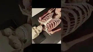 Anatomy In 3d- Client lying on the back- transparent muscle View