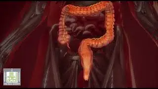الأمعاء الغليظة