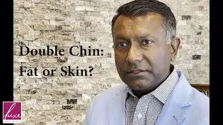 Double Chin--Fat or Skin?
