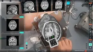 Doctor’s Aid Medivis SurgicalAR | AnatomyX 3D learning platform for medical education