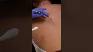 ASMR | Real person BACK INSPECTION 