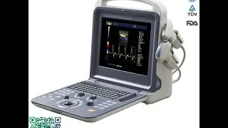 Portable 4d color doppler Ultrasound machine convex Operation video