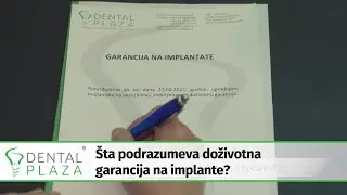 Šta podrazumeva doživotna garancija na implante?