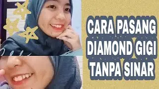 Cara Pasang Diamond Gigi / Permata Gigi Mudah, Kuat, Gak Ribet!