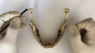 Нижняя челюсть - Mandibula