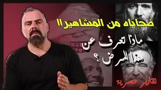 جيم كيري , روبن وليامز والعديد من المشاهير اصيبوا به!! - ماذا تعرف عن هذا المرض الغامض؟؟