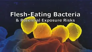 Flesh-Eating Bacteria and Potential Exposure Risks