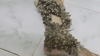 cute girl remove a million beauty ticks on her hand 