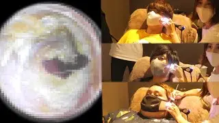 【耳掃除】23年間耳かきをしなかった人がプロに掃除してもらったらラスボスがいたｗｗｗｗｗ
