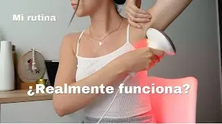 Rutina de DEPILACIÓN IPL |  2 años Resultados | Philips Lumea Advanced