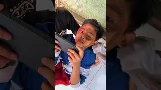 Exposed to cell phone radiation 