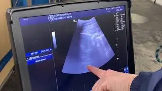 Equine Fetal Heart Beat