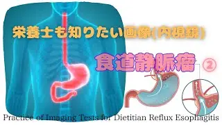 #112②【栄養士も知りたい画像(内視鏡)_逆流性食道炎】Practice of Imaging Tests for Dietitian Reflux Esophagitis