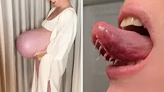 People With Rarest Features That No One Was Supposed To Have