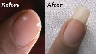 How to Grow Nails Faster Naturally? - SuperWowStyle