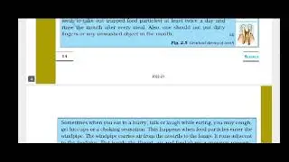 What are the Causes of Tooth decay | How to prevent tooth decay | Solutions for teeth problems