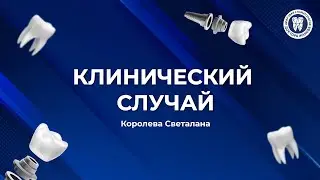 Как проходит лечение кариеса под микроскопом?