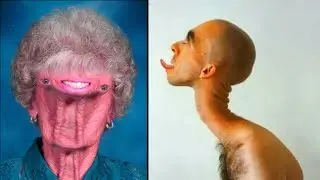 Unsual humans in the world | Unsual human body parts | Unsual Humans