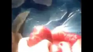 Removing parasites from the intestinal of the 3 year old child