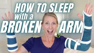 How to Sleep With A Broken Arm: SLEEPING POSITONS WITH A CAST