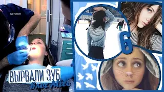 НЕУДАЧНИК ! Влог Alice (6 ). Пропал чемодан. Вырвали зуб. Сожгла кастрюлю